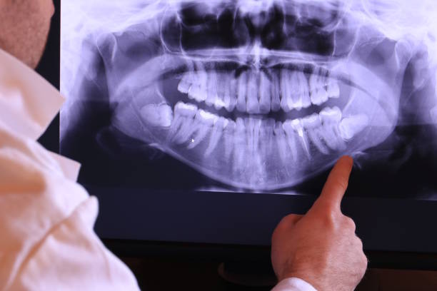 Best Urgent Care for Lost Fillings or Crowns in Hawthorne, NJ